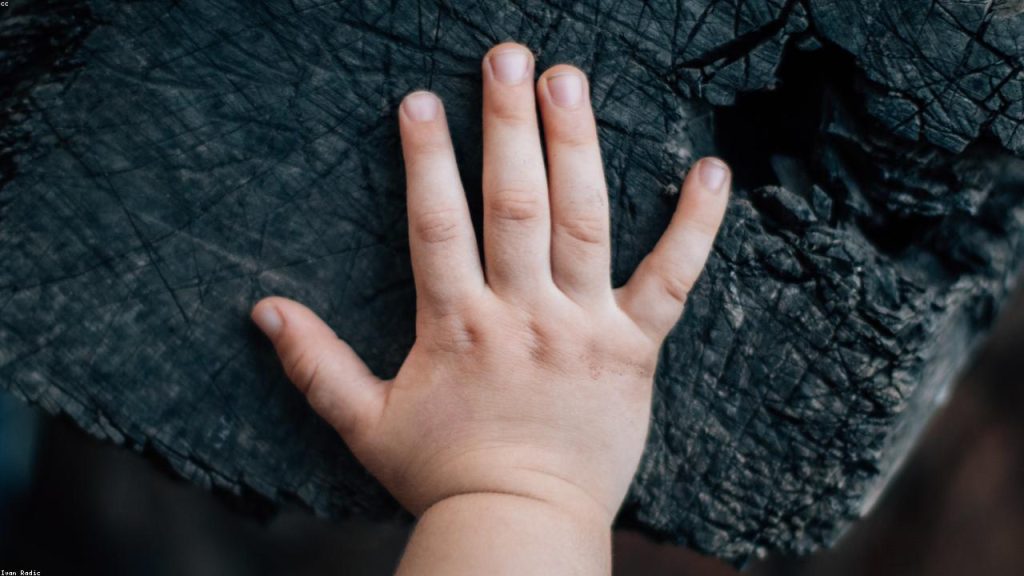 Cocuklarda istahsizlik yonetimi: aileler icin hizli baslangic - Ilk 14 gun