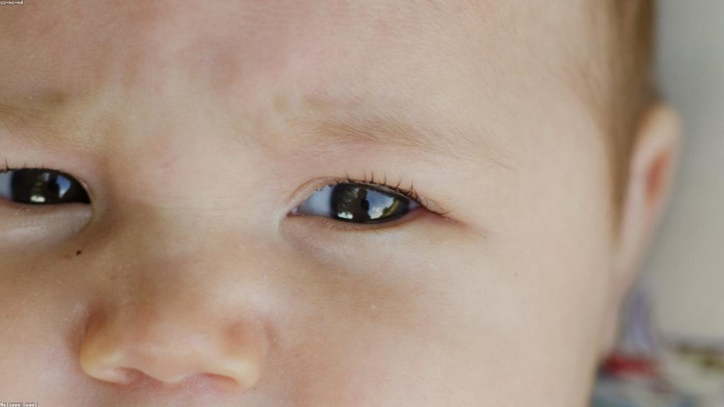 Emzirme döneminde protein ihtiyacı